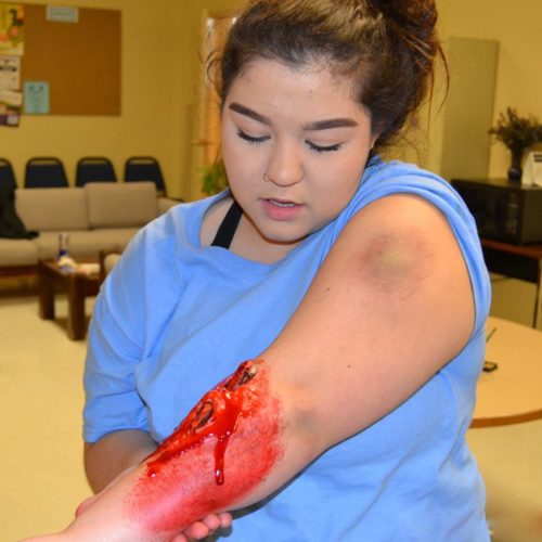 CB-Tech student with moulage on them.